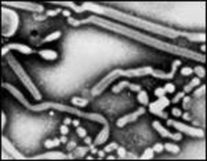 influenza_a2.jpg (15380 bytes)
