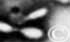 influenzab.jpg (4031 bytes)